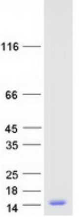 SDS PAGE (TXN-2132H).jpg